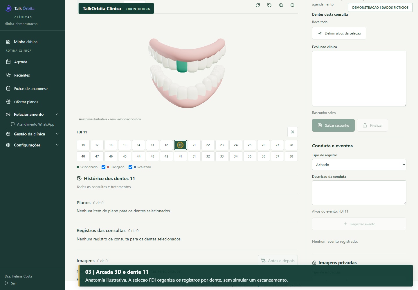 Prontuário odontológico do Talk Órbita com arcada ilustrativa 3D e seleção do dente 11 em paciente fictícia.